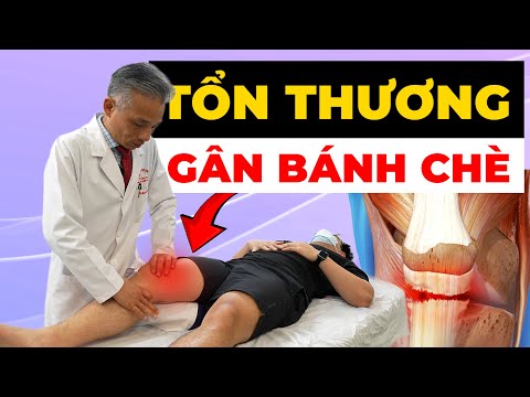 KHỔ SỞ VÌ GÂN BÁNH CHÈ? 90% Người Bệnh Hồi Phục Nhờ Phương Pháp Này