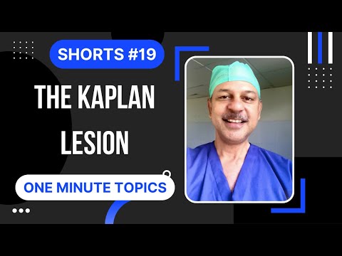 Shorts #19: The Kaplan lesion - Pathoanatomy and Xray findings - explained in less than a minute