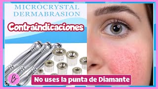 Microdermoabrasion mi peor experiencia 😳 @RosyLopezBeauty