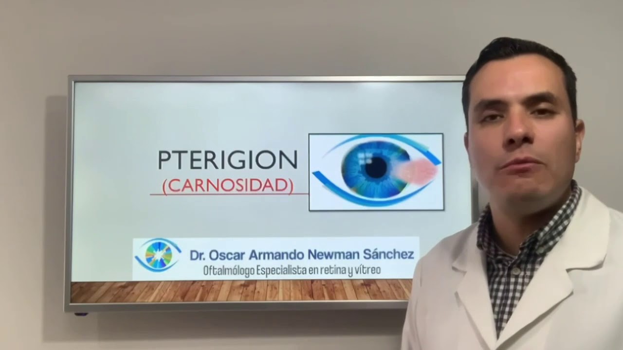 Oscar Armando Newman Sanchez-17