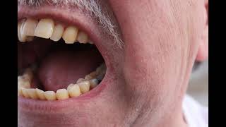 David Wilcox - Carpenter Story &amp; Fearless Love