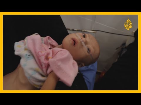 13.5 مليون يمني معرضون للمجاعة.. والأمم المتحدة تحذر من تضاعف العدد