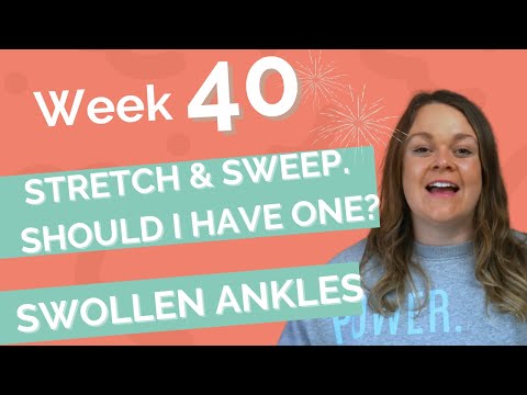 40 Weeks Pregnant .. WHAT TO EXPECT at 40 weeks. Due date. STRETCH & SWEEP should I have one?