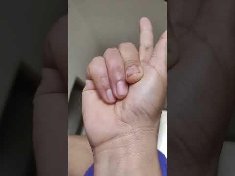 4 finger 😂😂😂 #shortsreels #comedy #mrrox #funny