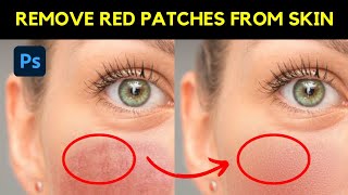 Smooth Skin and Remove Red Patches from an Image - Photoshop Tutorial #photoshop #skinretouching