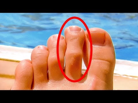 Physiotherapie nach Kniegelenk Fraktur Heilgymnastik für die Behandlung der lumbalen