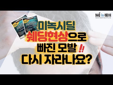 미녹시딜 쉐딩현상으로 빠진 모발 다시자라나요 - 뉴헤어 I 모발이식 I 탈모QnA I