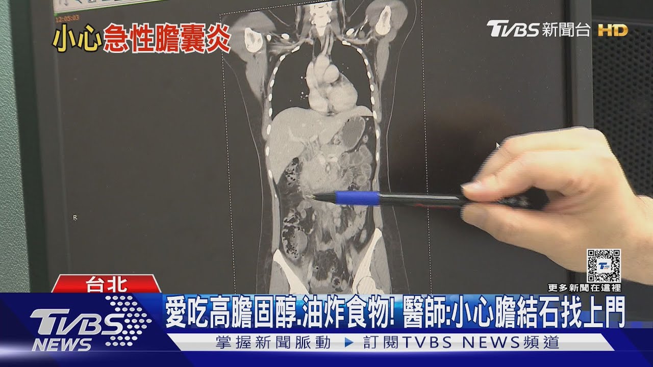 注意! 愛吃美食、精緻食物、炸物....身體「這部位」劇烈疼痛 醫師警告:手術切除....