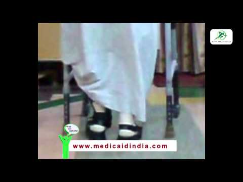 Ankle Brace Support Orthosis in Mumbai