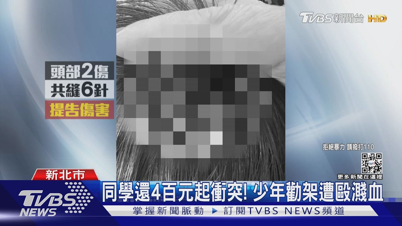 同學還4百元起衝突!少年勸架遭毆濺血 父母心痛提告
