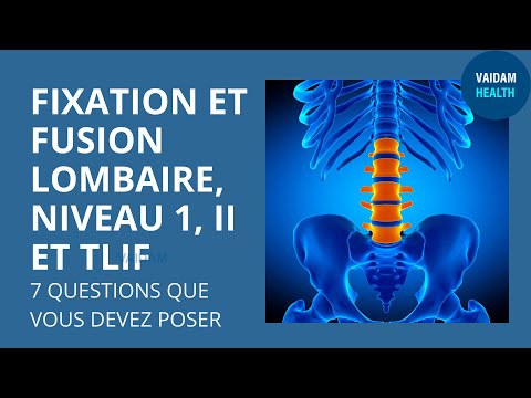 FIXATION ET FUSION LOMBAIRE, NIVEAU 1, II ET TLIF