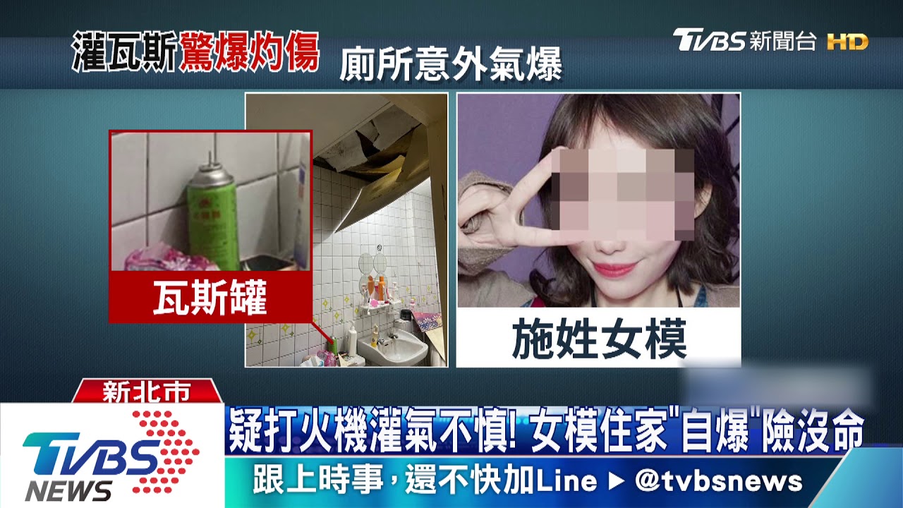 救我!雜誌女模住家「氣爆」 全身40%燒燙傷