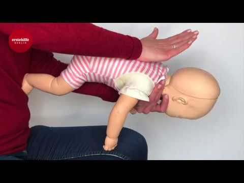 Fremdkörper Notfall Säugling und Kleinkind