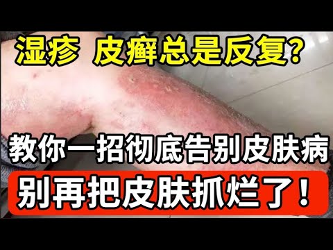 枯里珍功效