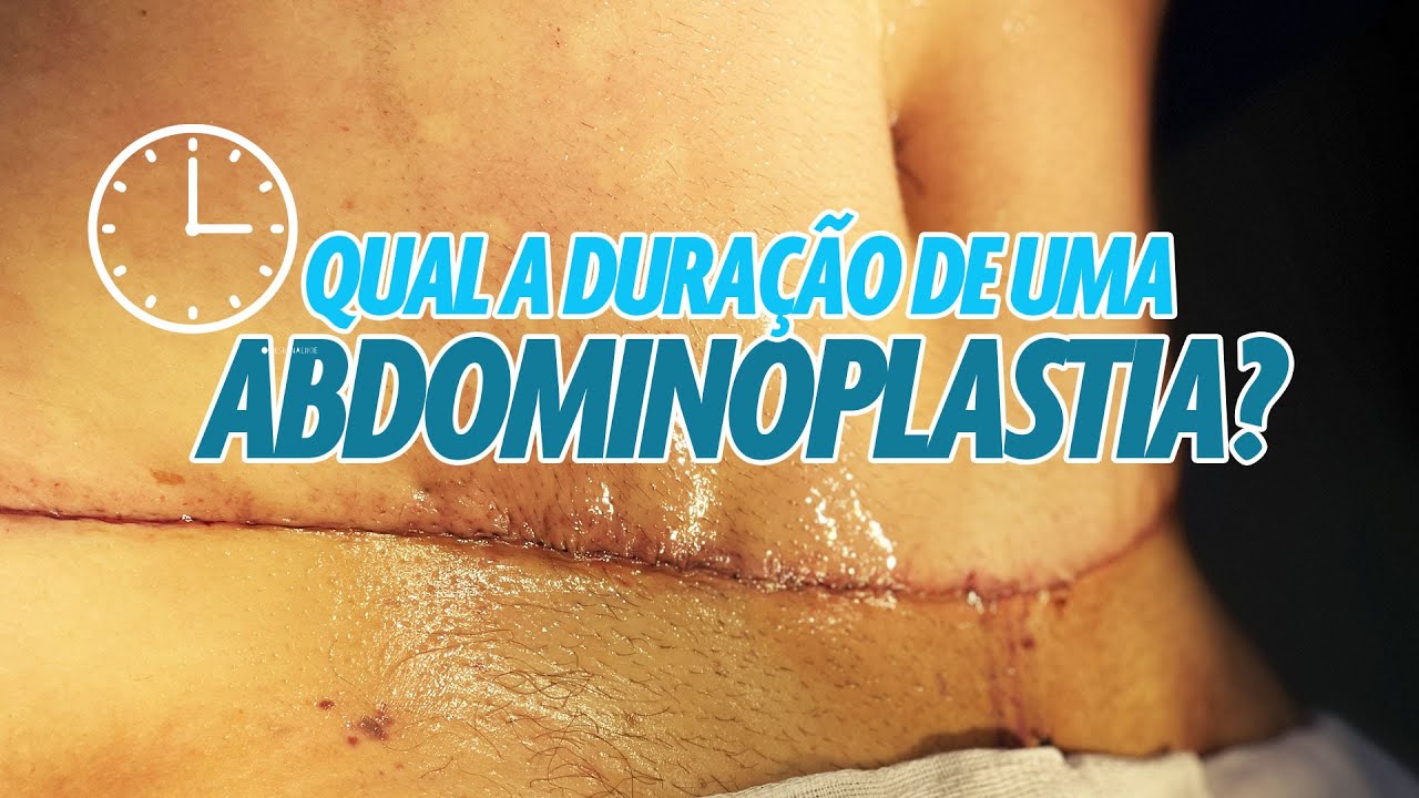 QUAL A DURAÇÃO DE UMA ABDOMINOPLASTIA? CIRURGIA PLÁSTICA