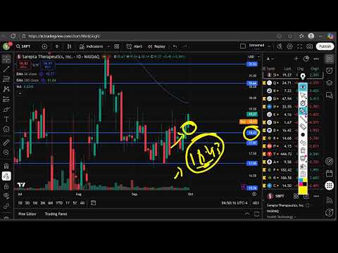 SRPT Stock (Sarepta Therapeutic stock) SRPT STOCK PREDICTION SRPT STOCK analysis SRPT stock news