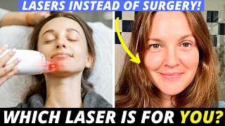 Lasers 101 for Anti-Aging (Everything You Need to Know to Pick the BEST For You!)