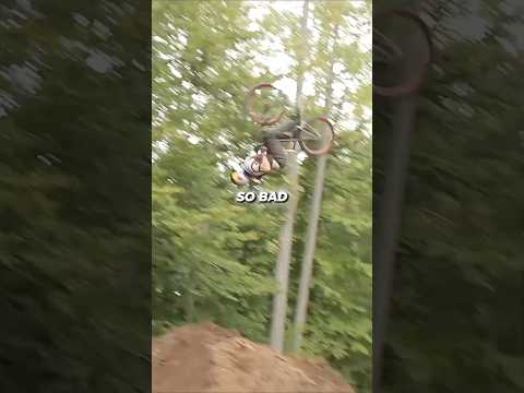 He Has Broken Over 90 Bones.. #fypシ゚viral