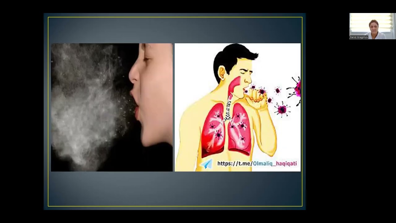 Tuberkulyoz epidemiologiyasi, profilaktikasi va epidemiologik nazorati