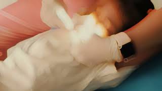 Lần đầu tiên đi nhổ răng| Thay răng tuổi lên 6 |Quí Ni Channel