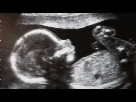 download lagu mp3 mp4 Poema Del Aborto Raul Brindis, download mp3 Poema Del Aborto Raul Brindis free download mp3, download mp3 Poema Del Aborto Raul Brindis