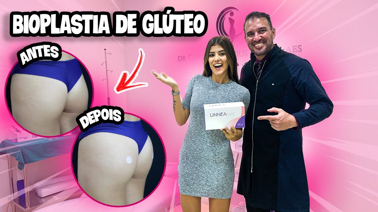 CHEGOU O DIA DA CIRURGIA:  BIOPLASTIA DE GLÚTEO!!!