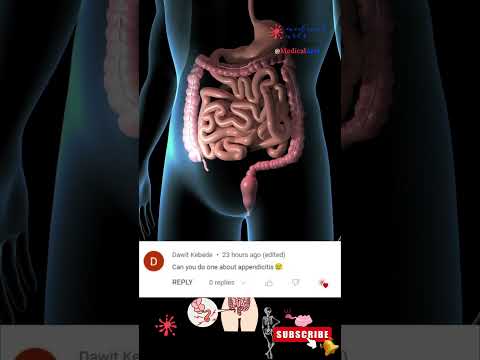 Appendicitis [] Appendix Location [] Appendicitis symptoms