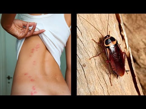 Strisci pinworm il trattamento Composizione di tè monastico da parassiti