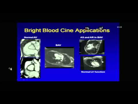 CARDIO RADIOLOGY CME PART 1