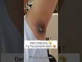 Best Home Remedies For Dark Underarms Shorts Skincare Smbeautylandstudio