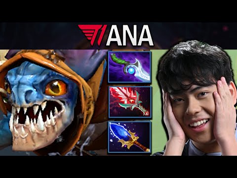 Slark Dota 2 Gameplay T1.Ana with Diffusal and Aghanims Scepter #dota2 #dota2gameplay