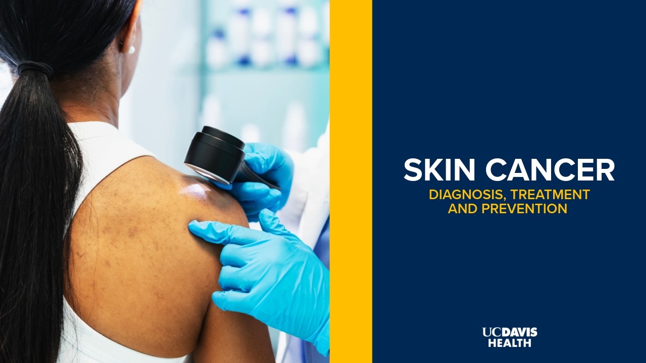 Thumbnail preview of How to Spot and Prevent Skin Cancer: Tips From a Dermatologist