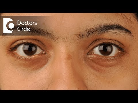 What causes Dark Circles under eyes? - Dr. Rasya Dixit