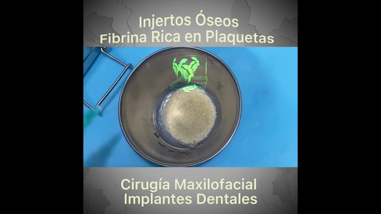 Jose Fernando Fragozo Mendoza-16