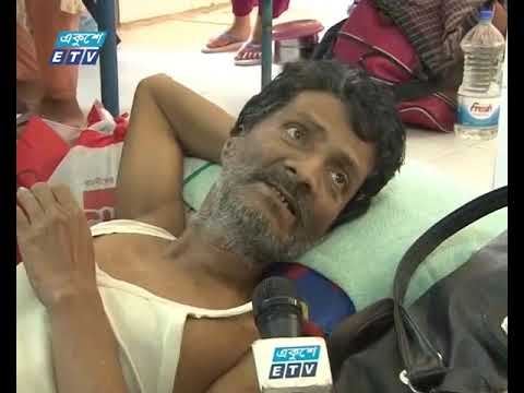 আগুনে পোড়া রোগীদের চিকিৎসার সুযোগ সীমিত