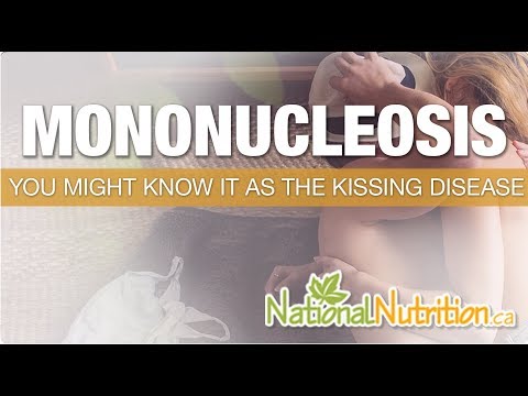 Symptoms of Mononucleosis