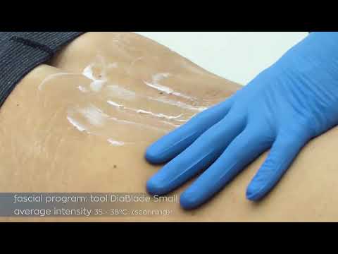 Апарат для ТЕКАР-терапии DIACARE 7000 GLOBUS Италия - фото 3 - id-p1433684297