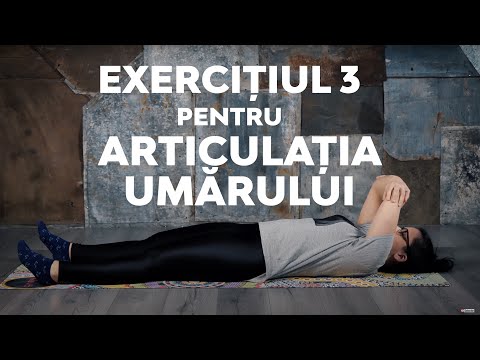 Unguente pentru tratamentul artritei artrite