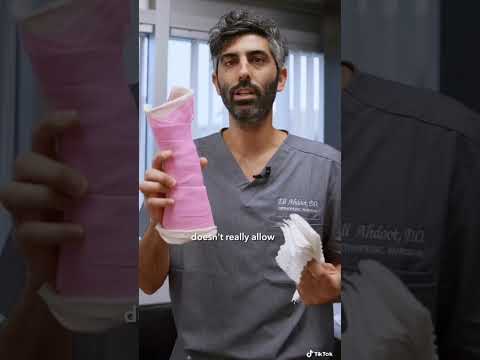 CAST vs SPLINT? Why is one used vs the other in orthopedics? #education #Nurses #injury #SignMyCast