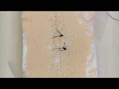 Simple Interrupted Sutures with Instrument Tied Knots