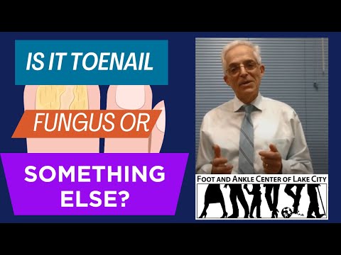Is It Toenail Fungus, Trauma, or Something Else?