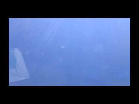 Video di esercizi per la spalla Popova congiunta Dolore al collo quando si gira la testa verso sinistra