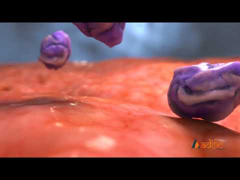 Medical Showreel - Viral Marketing Hub