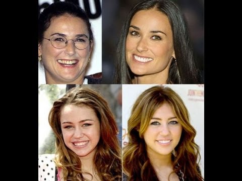Holllywood stars before and after cosmetic dental surgery + basic dental hygiene tips.