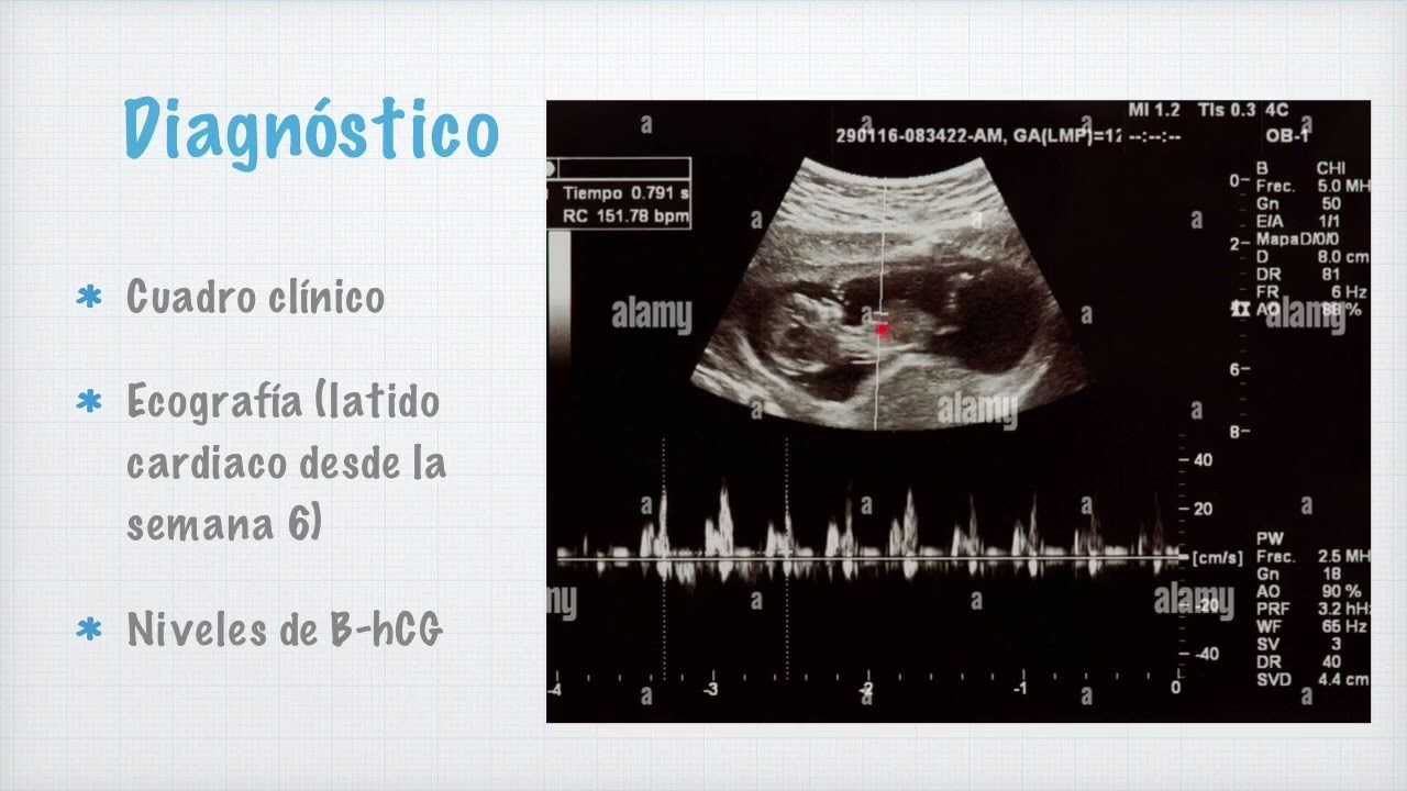 Sangrados de la primera mitad del embarazo