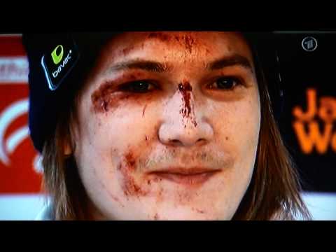 ARD-Bericht zum norwegischen Skisprungteam in Klingenthal