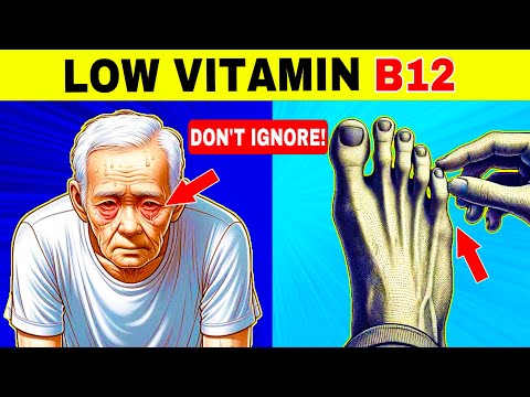 7 WEIRD SIGNS of LOW VITAMIN B12 (Symptoms of Vitamin B12 Deficiency)