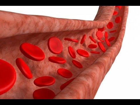 La curvatura del pene chirurgia prezzo Un organo di testa allargata del bambino