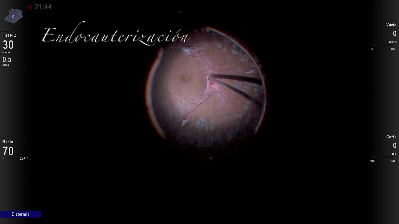 Marco Antonio Rayón Rodríguez-16