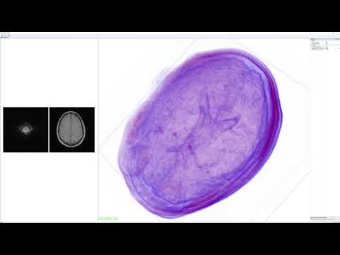 Program video
